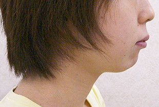 口元集 右 before