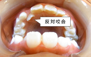 9歳（小学校4年生）　初めてのご相談