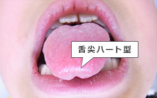 舌尖ハート型